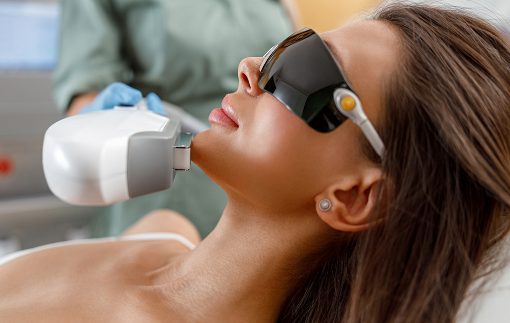 Intense Pulsating Light (IPL)